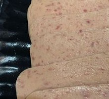 Spam