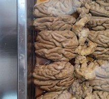 Brain tissue