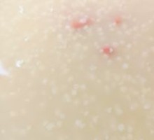 Rice Porridge