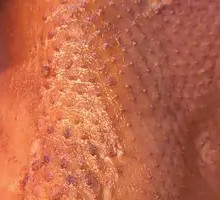 Oil-Scalded Goose