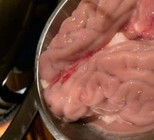 Brain tissue