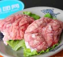 Sheep Brain and Brainstem
