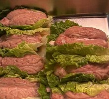 Fresh Brain Tissue
