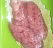 Brain tissue