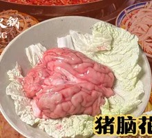 Brain tissue