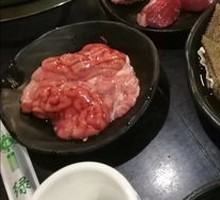 Brain tissue