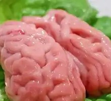 Fresh Brain Tissue